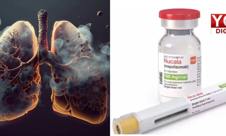 Nucala, GSK, FDA approval, COPD, smoker’s lung,